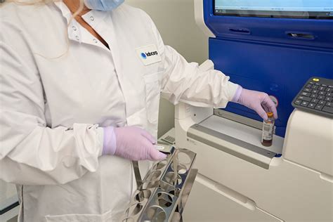 LabCorp blood sample preparation